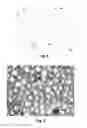 Fig. 05 - METHODS FOR DRIVING ELECTROPHORETIC DISPLAYS USING DIELECTROPHORETIC FORCES
