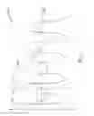 Fig. 10 - Hand-held spherical antenna system to detect transponder tagged objects, for example during surgery