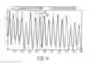 Fig. 09 - Estimating respiratory phase from a video of a subject