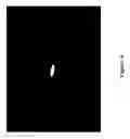 Fig. 09 - Process and device for direct measurements of plant stomata