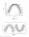 Fig. 06 - Method for automatic tooth type recognition from 3D scans