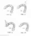 Fig. 09 - Method for automatic tooth type recognition from 3D scans
