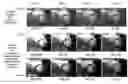 Fig. 01 - System and apparatus for real-time processing of medical imaging raw data using cloud computing