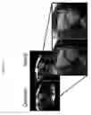 Fig. 22 - System and apparatus for real-time processing of medical imaging raw data using cloud computing