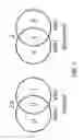 Fig. 04 - OPTICAL COHERENCE TOMOGRAPHY GLAUCOMA DETECTION BASED ON RETINAL VESSEL RELIEF HEIGHT
