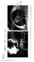 Fig. 10 - Image registration device, image registration method, and image registration program