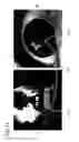 Fig. 12 - Image registration device, image registration method, and image registration program