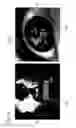Fig. 13 - Image registration device, image registration method, and image registration program