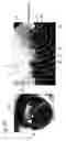 Fig. 17 - Image registration device, image registration method, and image registration program