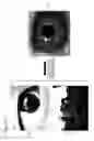 Fig. 18 - Image registration device, image registration method, and image registration program