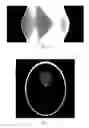 Fig. 06 - Image reconstruction