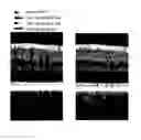 Fig. 01 - Systems and methods to remove shadowgraphic flow projections in OCT angiography