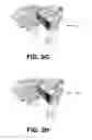 Fig. 06 - Maintaining consistent boundaries in parallel mesh simplification