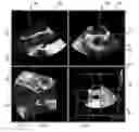 Fig. 01 - MOTION ADAPTIVE VISUALIZATION IN MEDICAL 4D IMAGING