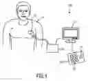 Fig. 02 - MOTION ADAPTIVE VISUALIZATION IN MEDICAL 4D IMAGING