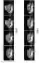 Fig. 06 - MOTION ADAPTIVE VISUALIZATION IN MEDICAL 4D IMAGING