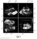 Fig. 07 - MOTION ADAPTIVE VISUALIZATION IN MEDICAL 4D IMAGING