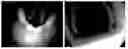 Fig. 01 - MODULAR SURGICAL SIMULATION TRAINER AND METHODS OF USE
