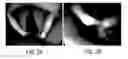 Fig. 03 - MODULAR SURGICAL SIMULATION TRAINER AND METHODS OF USE