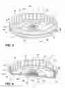 Fig. 04 - Multi-component rotor for an electric motor of an appliance