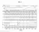 Fig. 03 - Ultra low power wideband non-coherent binary phase shift keying demodulator using first order sideband filters with phase zero alignment