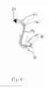 Fig. 05 - Hearing aid