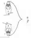 Fig. 11 - TINNITUS TREATMENT SYSTEMS AND METHODS