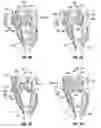 Fig. 06 - Root crop harvester