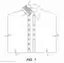 Fig. 02 - Combined Collar Stabilizer and Button Closure Tool
