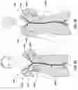 Fig. 04 - Garment having interchangeable portions