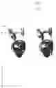 Fig. 24 - Object having a movable jewelry element