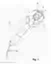Fig. 02 - Hair shaping device