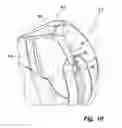 Fig. 08 - Hair shaping device