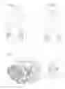 Fig. 02 - Epilator