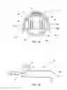 Fig. 05 - Nail clip and system for use in nail polish removal