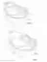 Fig. 02 - Infant enclosure