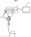 Fig. 06 - Endoscopic device