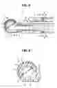 Fig. 04 - ENDOSCOPE
