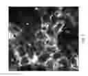 Fig. 04 - Hyperspectral imaging for detection of Parkinson's disease