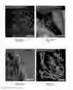 Fig. 16 - SYSTEMS AND METHODS FOR INJECTABLE DEVICES