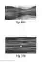 Fig. 24 - SYSTEMS AND METHODS FOR INJECTABLE DEVICES