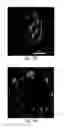 Fig. 26 - SYSTEMS AND METHODS FOR INJECTABLE DEVICES