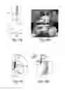Fig. 45 - SYSTEMS AND METHODS FOR INJECTABLE DEVICES
