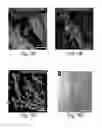 Fig. 46 - SYSTEMS AND METHODS FOR INJECTABLE DEVICES
