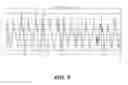Fig. 09 - Reducing electrocardiogram artifacts during and post CPR