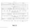 Fig. 17 - Reducing electrocardiogram artifacts during and post CPR