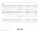 Fig. 20 - Reducing electrocardiogram artifacts during and post CPR