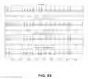 Fig. 25 - Reducing electrocardiogram artifacts during and post CPR