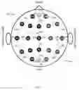 Fig. 02 - Measurement Device for Scalp Electrode Placement