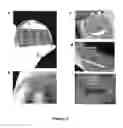Fig. 08 - Transparent, flexible, low-noise electrodes for simultaneous electrophysiology and neuro-imaging